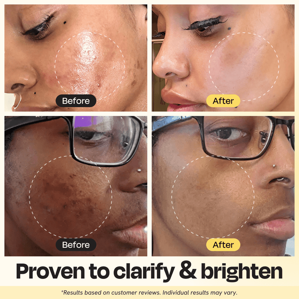 Vitamin C Facial Clay Mask
