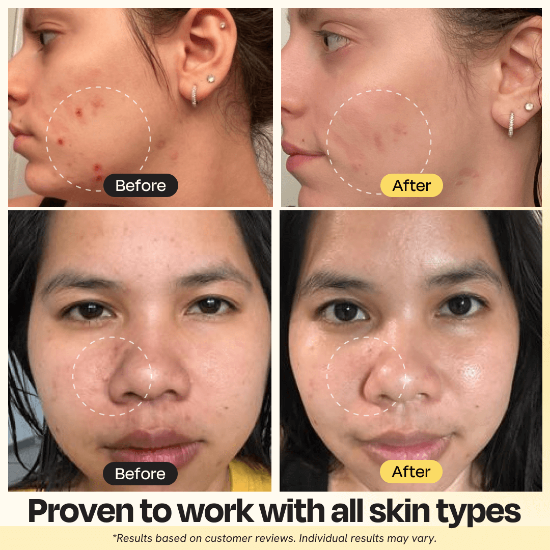 Vitamin C Facial Clay Mask