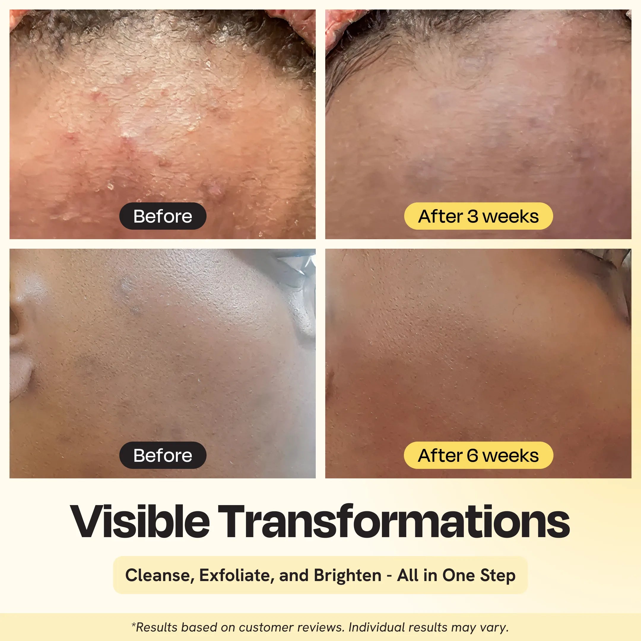 Clarifying Skin Brightening Cleanser