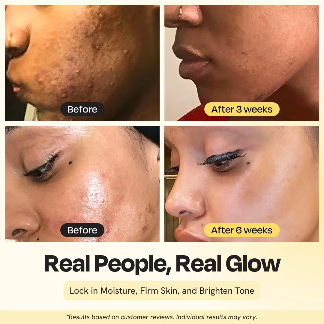 Supernutrient Skincare Oil